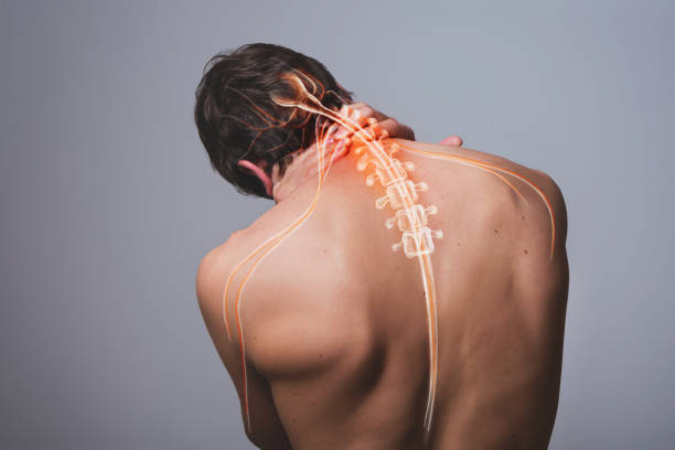 Nerve Conditions